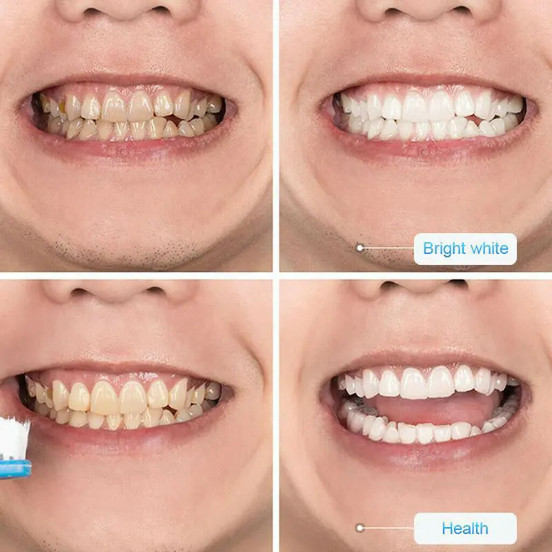 Momentiniai Brightify Pobūdžio dantų Pasta Dėmių Šalinimo Pabalti Šviesina Dantis 30ML M88