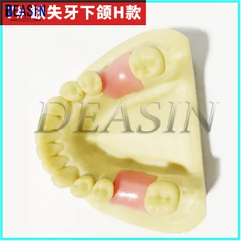1 vnt x Dantų Modelio Žodžiu implantus Žandikaulio Sinuso Minkštos Gumos